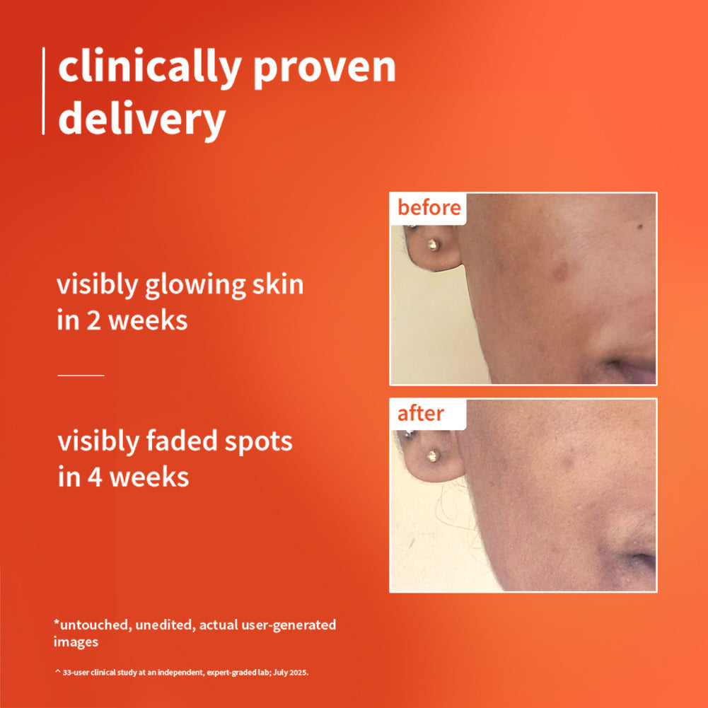 Plum Goodness 1% Vitamin C Ultra-Light-Glow Boosting Gel Cream For Glowing Skin