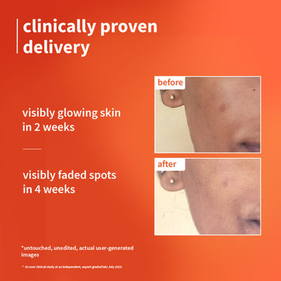 1% Vitamin C Ultra-Light-Glow Boosting Gel Cream For Glowing Skin