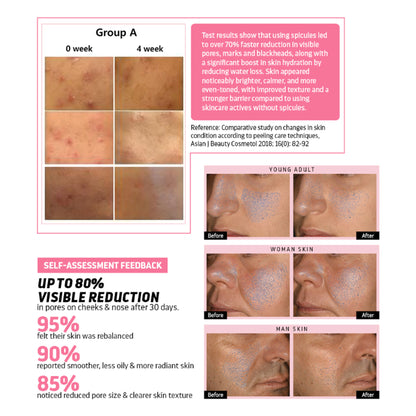 Indulgeo Essentials Cica Reedle Essence With PDRN