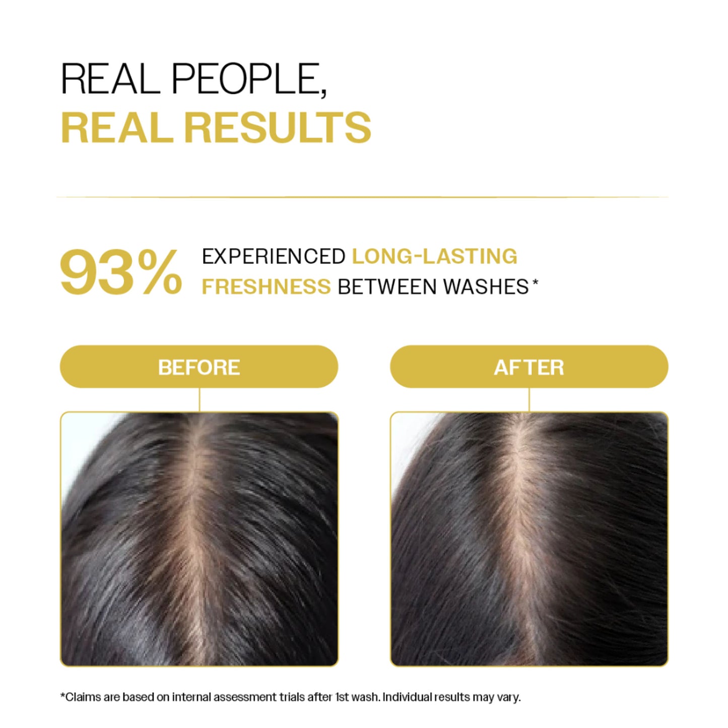 Bare Anatomy Oil Control Shampoo Sulphate-Free For Oily Scalp