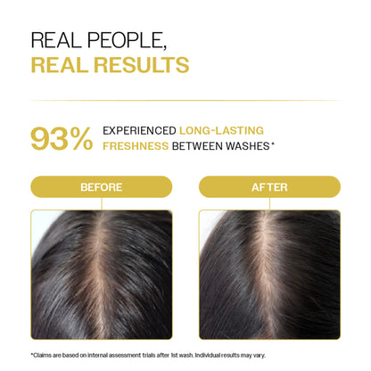 Bare Anatomy Oil Control Shampoo Sulphate-Free For Oily Scalp
