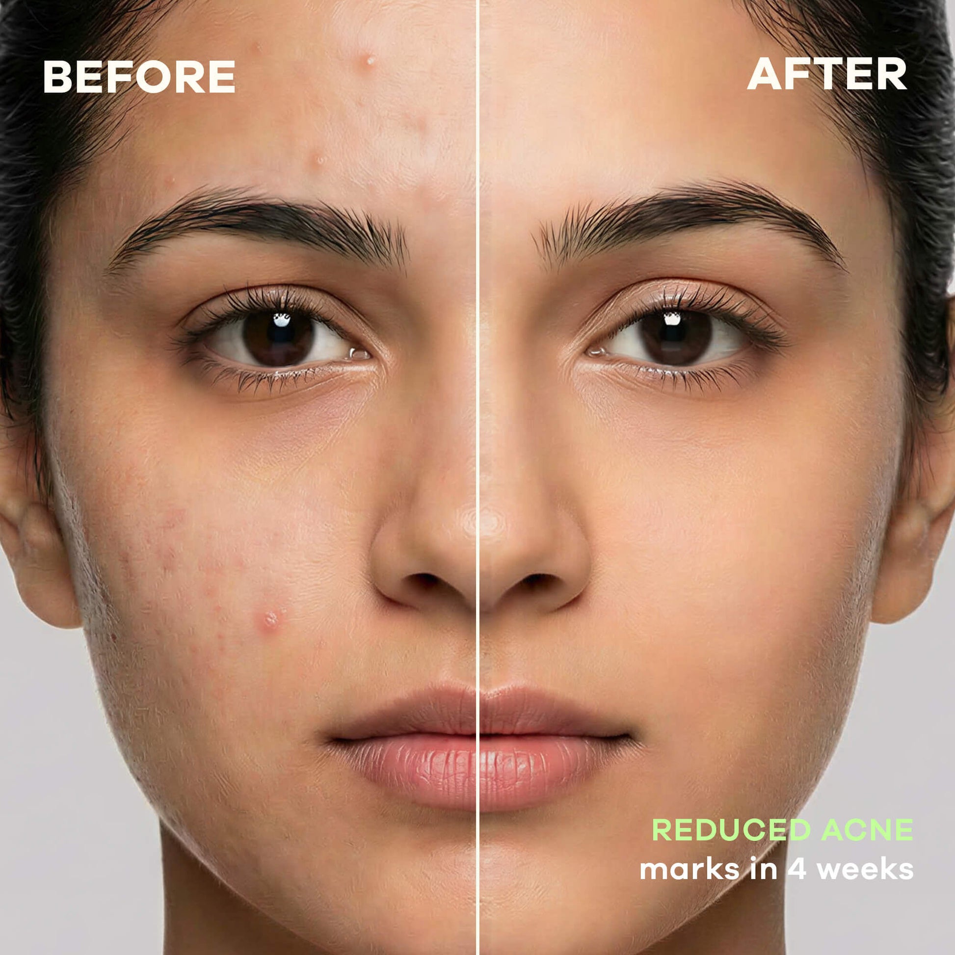 Earth Rhythm Healing Cica Gel, Calms Redness and Fades Acne Scars in 4 Weeks