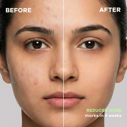 Earth Rhythm Healing Cica Gel, Calms Redness and Fades Acne Scars in 4 Weeks