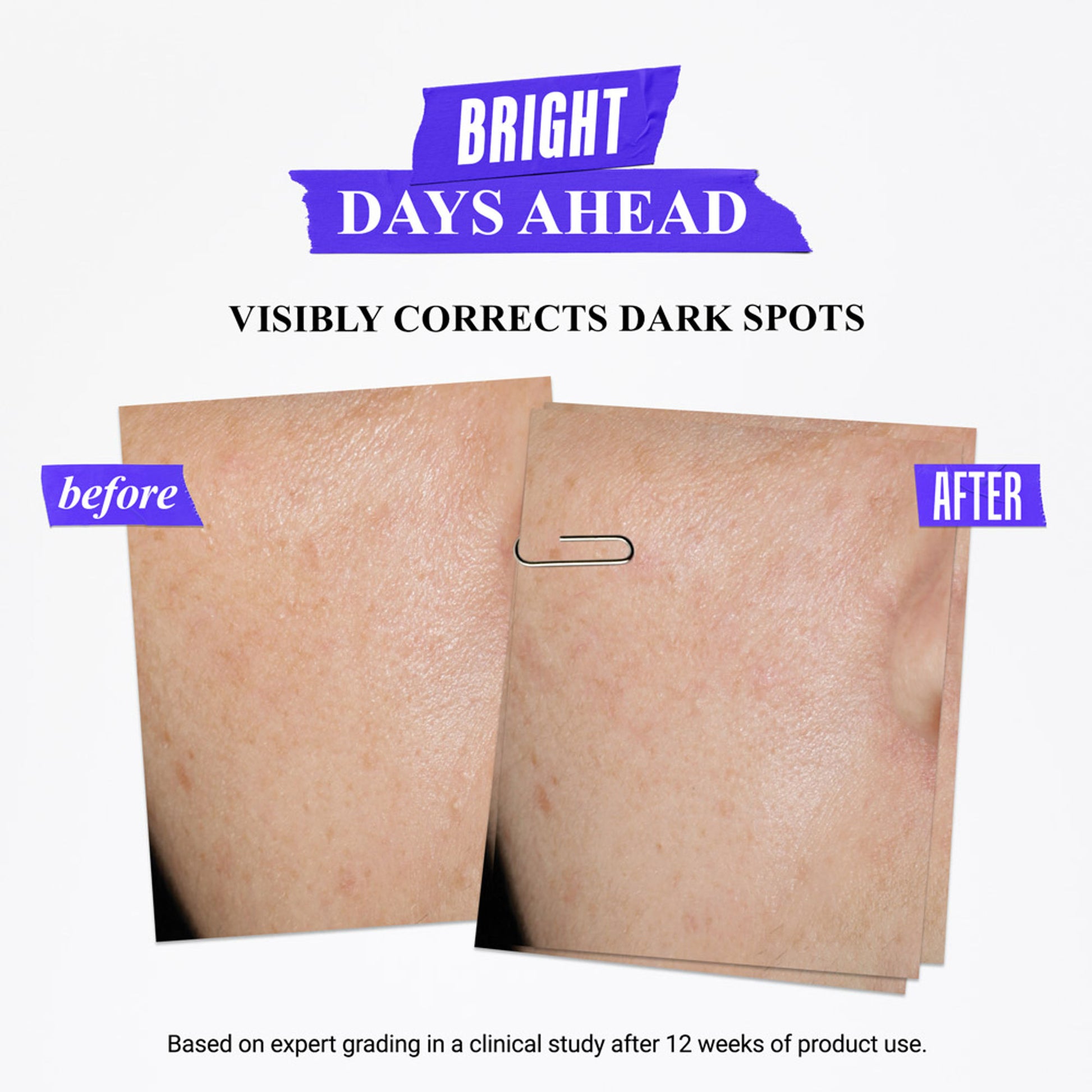 Kiehl's Clearly Corrective Dark Spot Solution With Activated C & Buffered Salicylic Acid