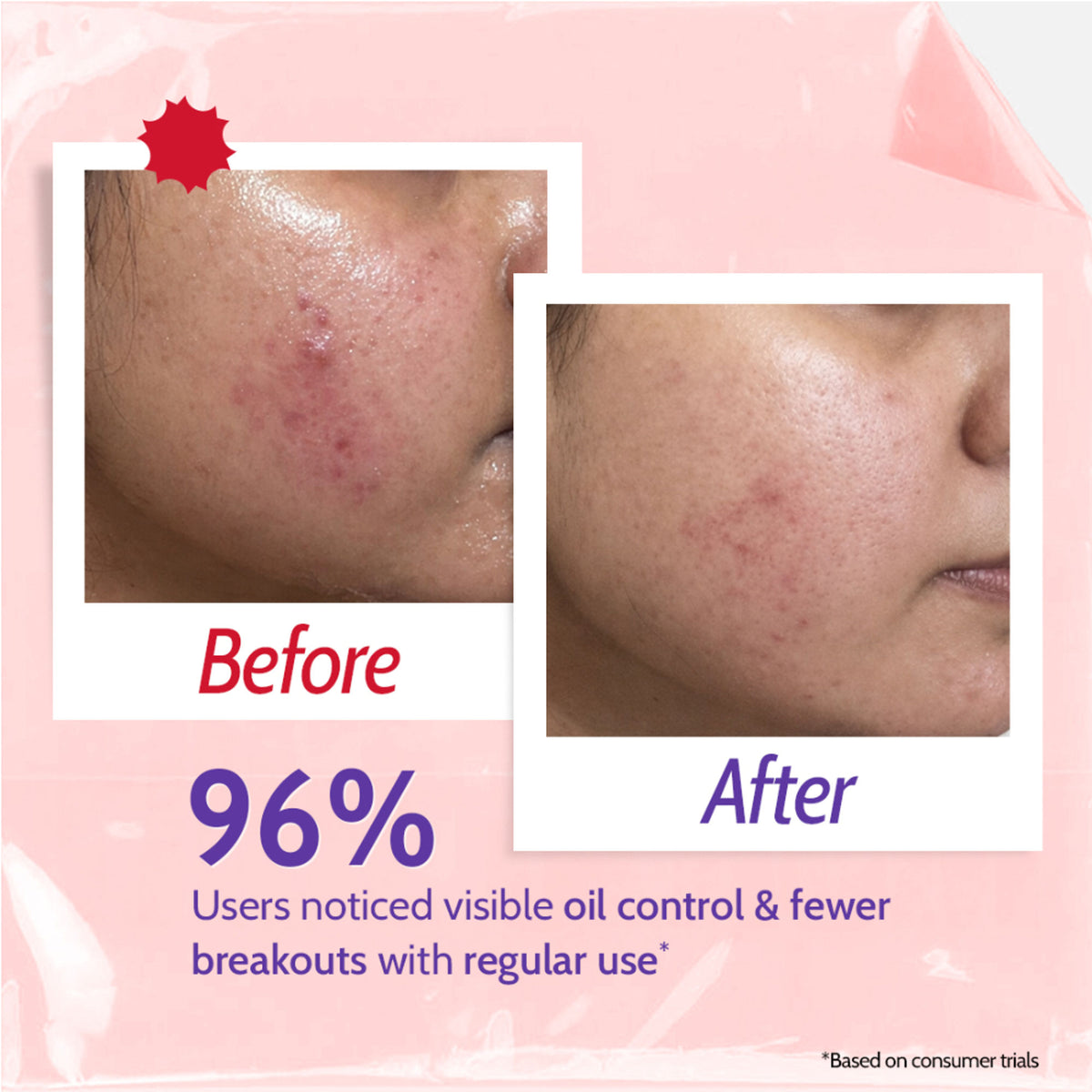 Chemist at Play 2% Salicylic Acid Face Wash with Niacinamide for oily skin, oil cleanser for clear, healthy complexion.