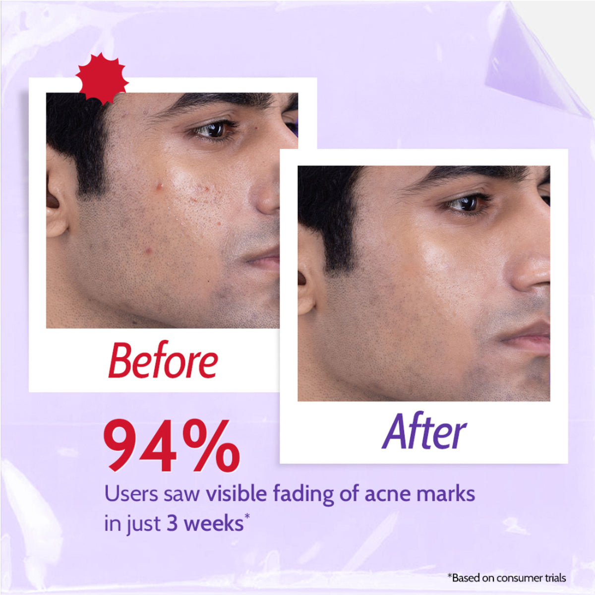 Chemist at Play 2% Salicylic Acid face wash with niacinamide for oily skin, oil cleanser for clear, balanced complexion.