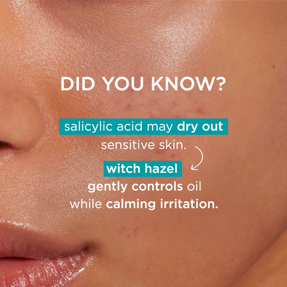 Simple Daily Skin Detox Purifying Facial Wash, 100% Soap Free | Gentle on Acne prone skin