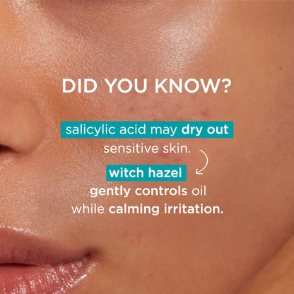 Simple Daily Skin Detox Purifying Facial Wash, 100% Soap Free | Gentle on Acne prone skin