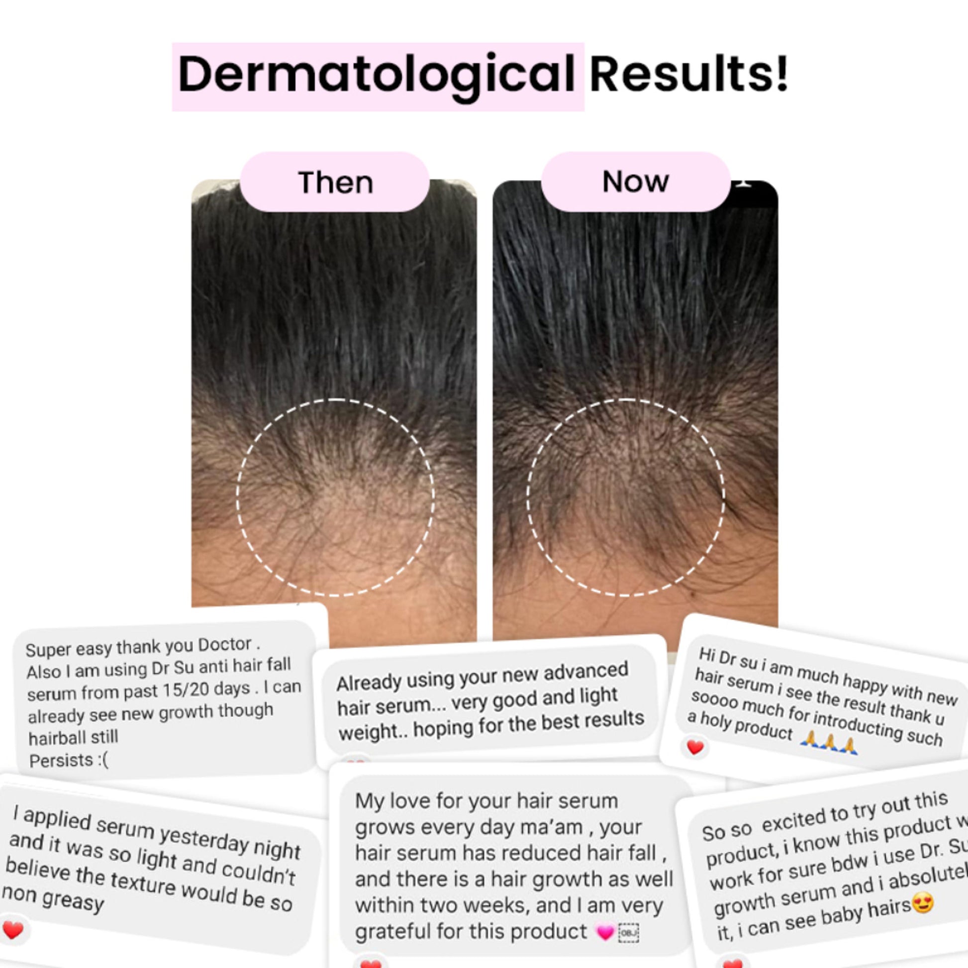 Dr. Su Revive Hair Growth Serum