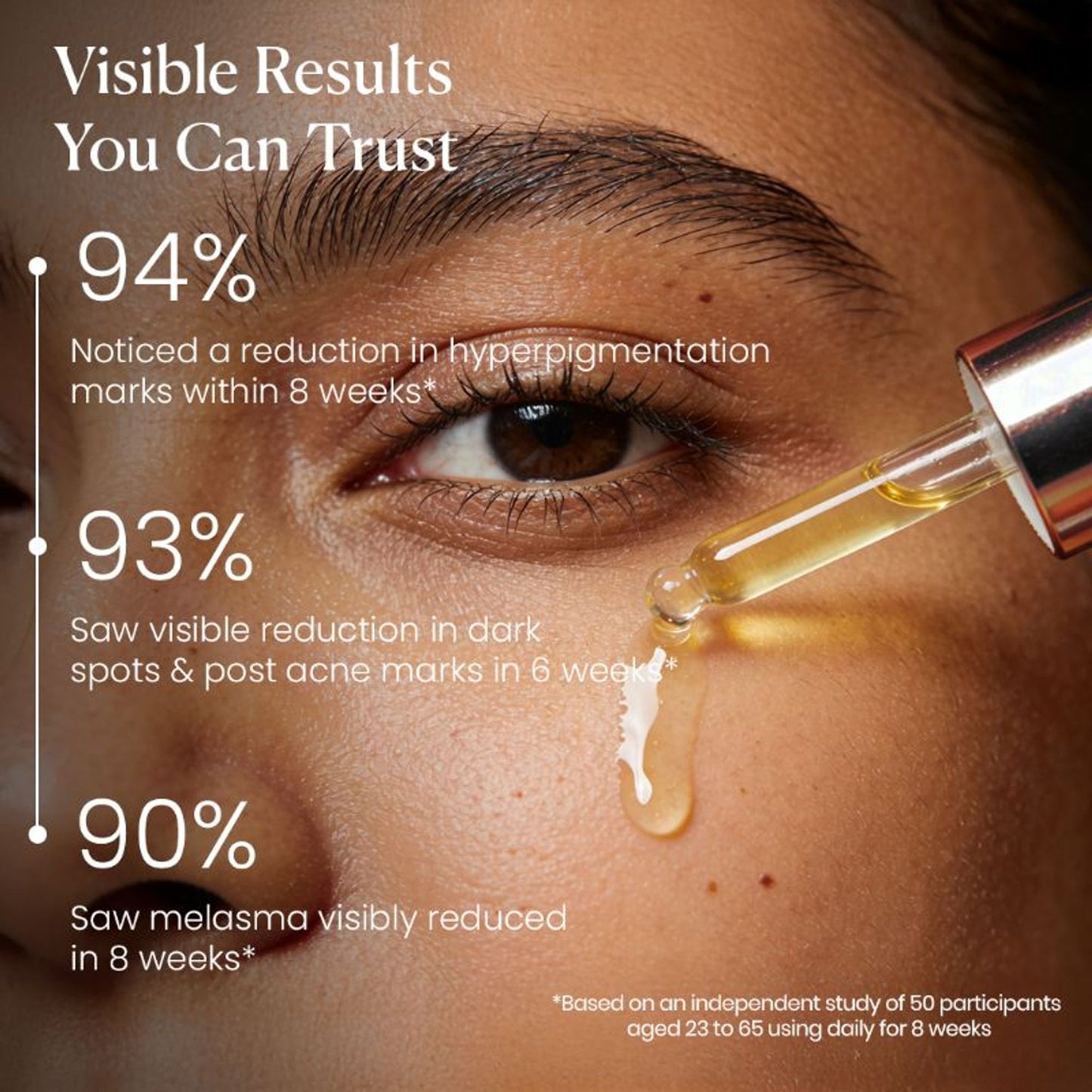 BiE - Beauty In Everything Zero Dark Spot Corrector & Anti-Pigmentation Serum