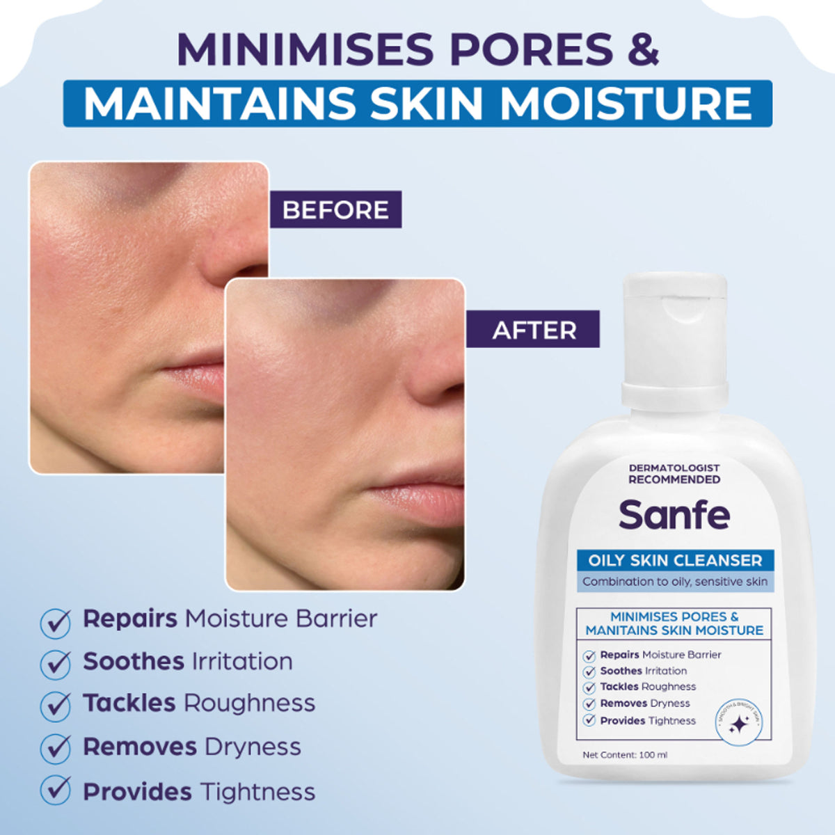 Sanfe Oily Skin Cleanser | For skin repair, dryness, tighter skin - For Oily, Acne Prone Skin, 100ml