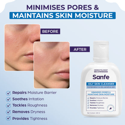 Sanfe Oily Skin Cleanser | For skin repair, dryness, tighter skin - For Oily, Acne Prone Skin, 100ml