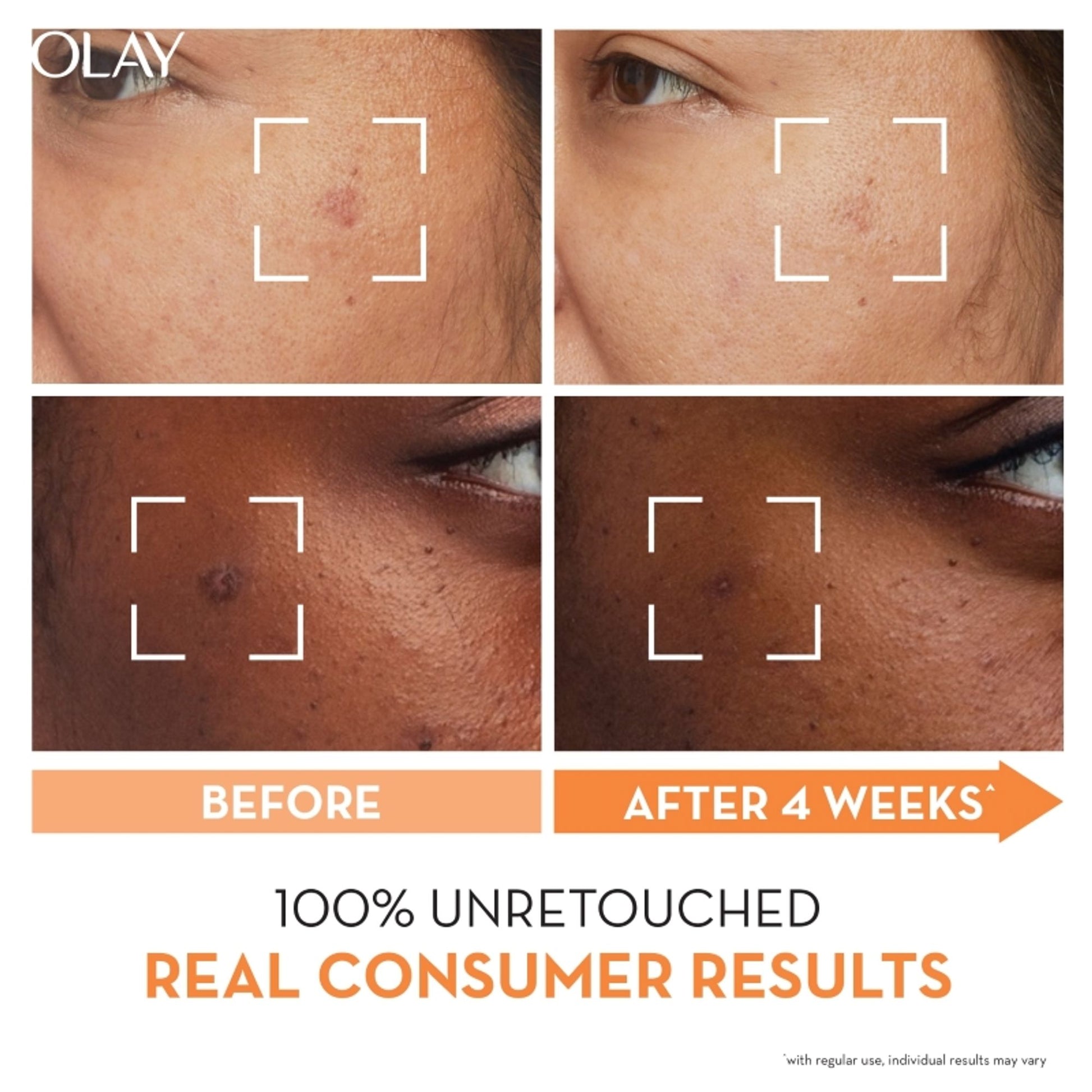 Olay Luminous Niacinamide Vitamin C Moisturiser