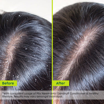 Plix Neem Anti-Dandruff Advanced Conditioner