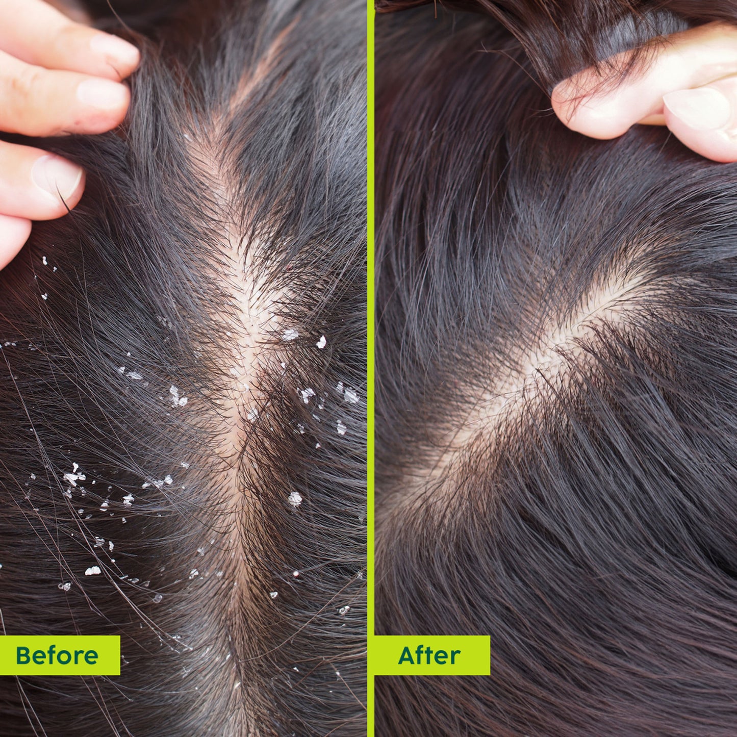 Plix Neem Anti-Dandruff Advanced Hair Oil