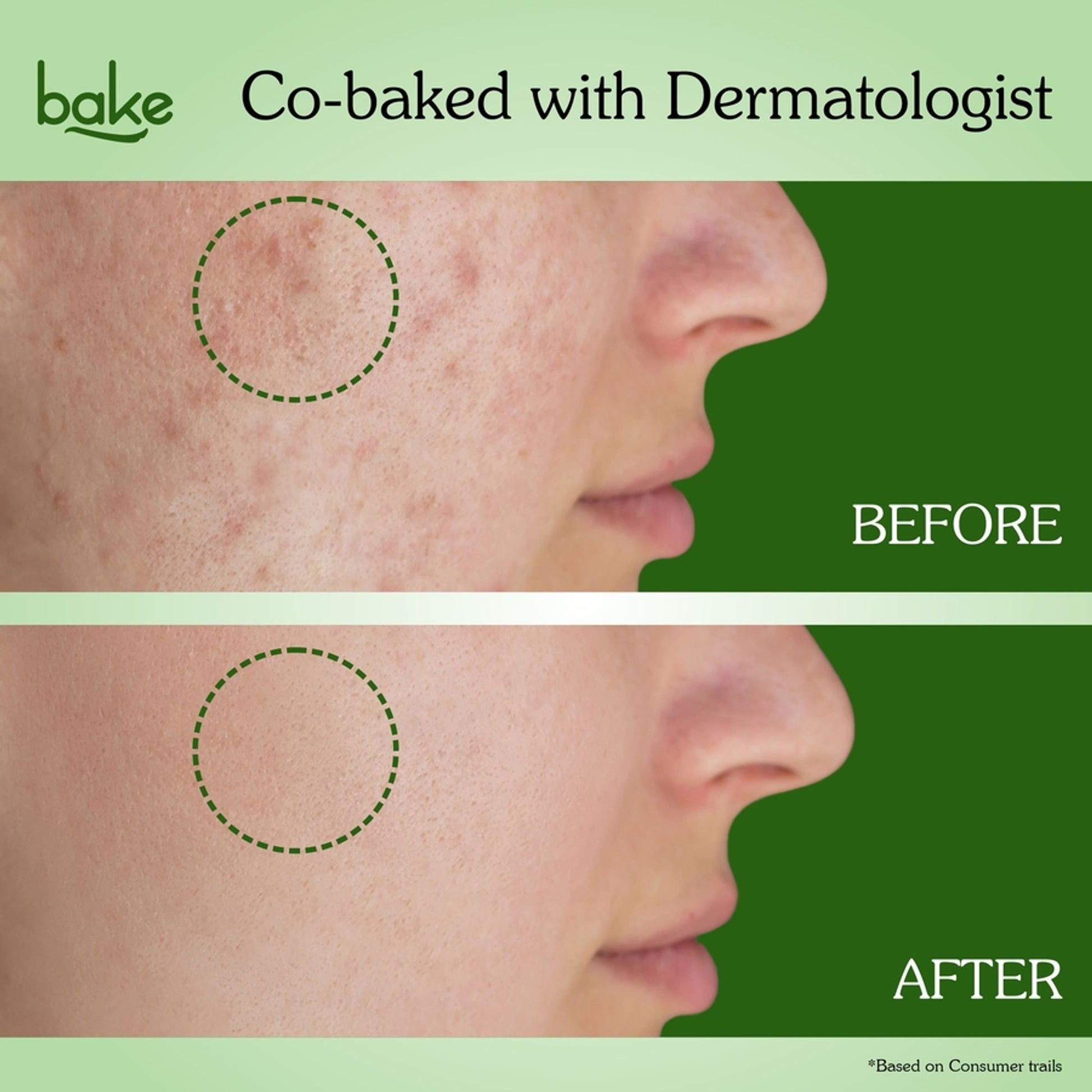 Bake 3% Niacinamide + 2% Salicylic Acid Face Wash For Acne & Acne Marks