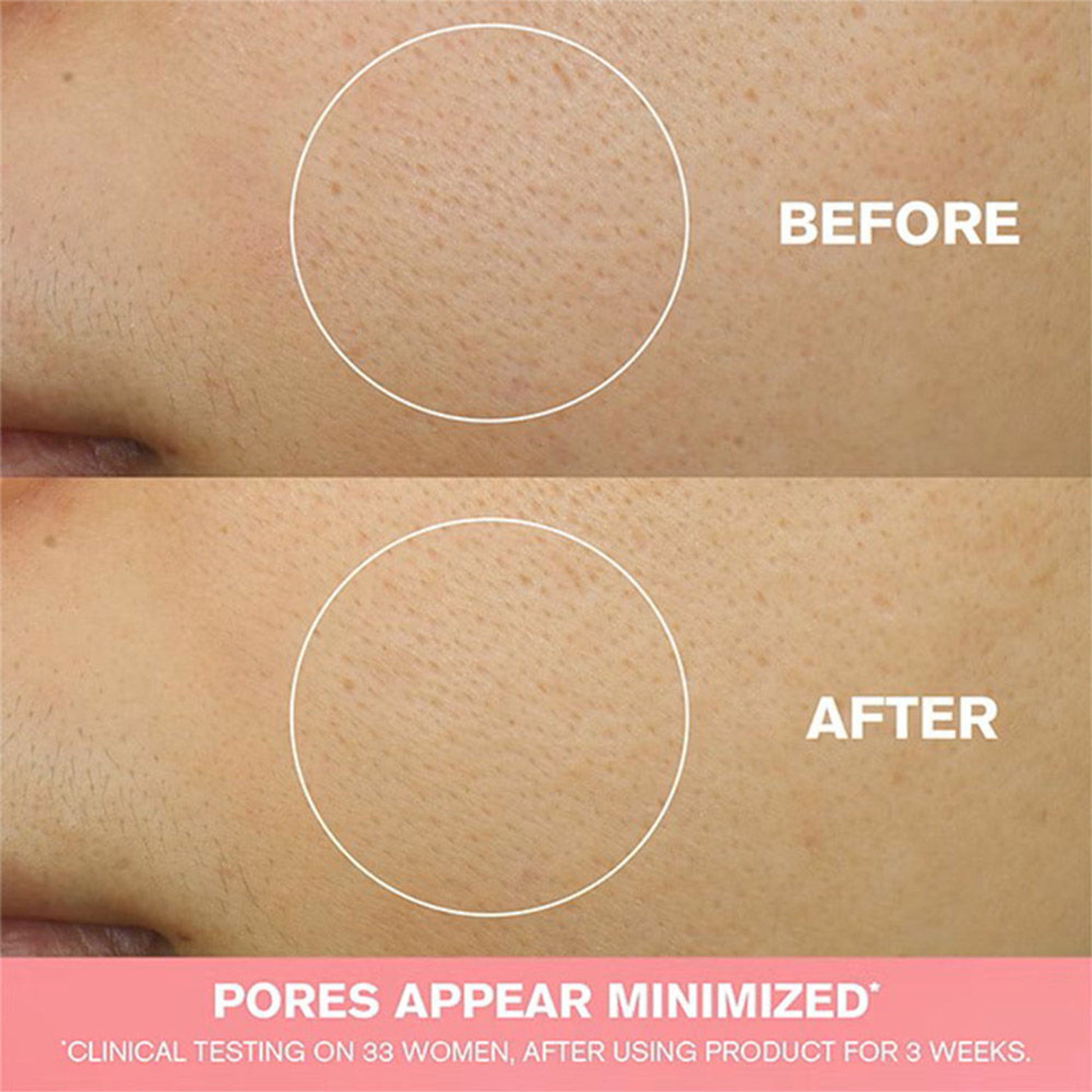 Estee Lauder Nutritious 2-In-1 Foam Cleanser with Niacinamide for Pore Minimization (For Oily Skin)