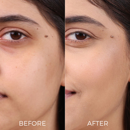 Brillare Professional Age Revival Moisturizer | Anti-Aging Moisturizer for Wrinkles & Fine Lines