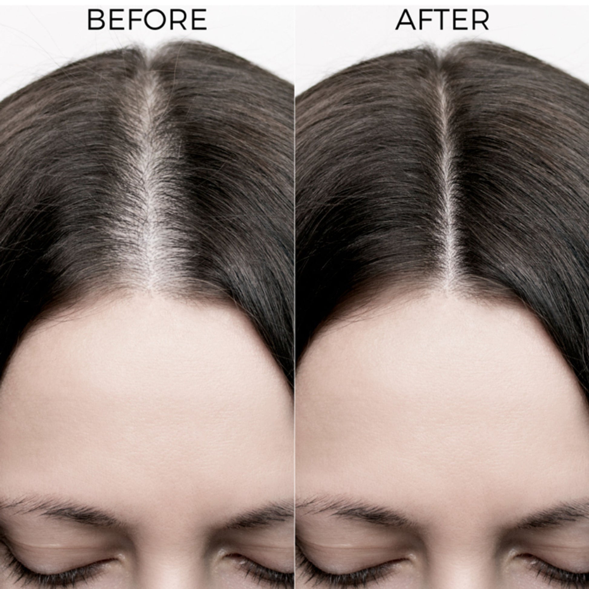 Brillare 20% Onion Hair Oil for Hair Fall Reduction Visible Hair Fall Reduction in 15 Days