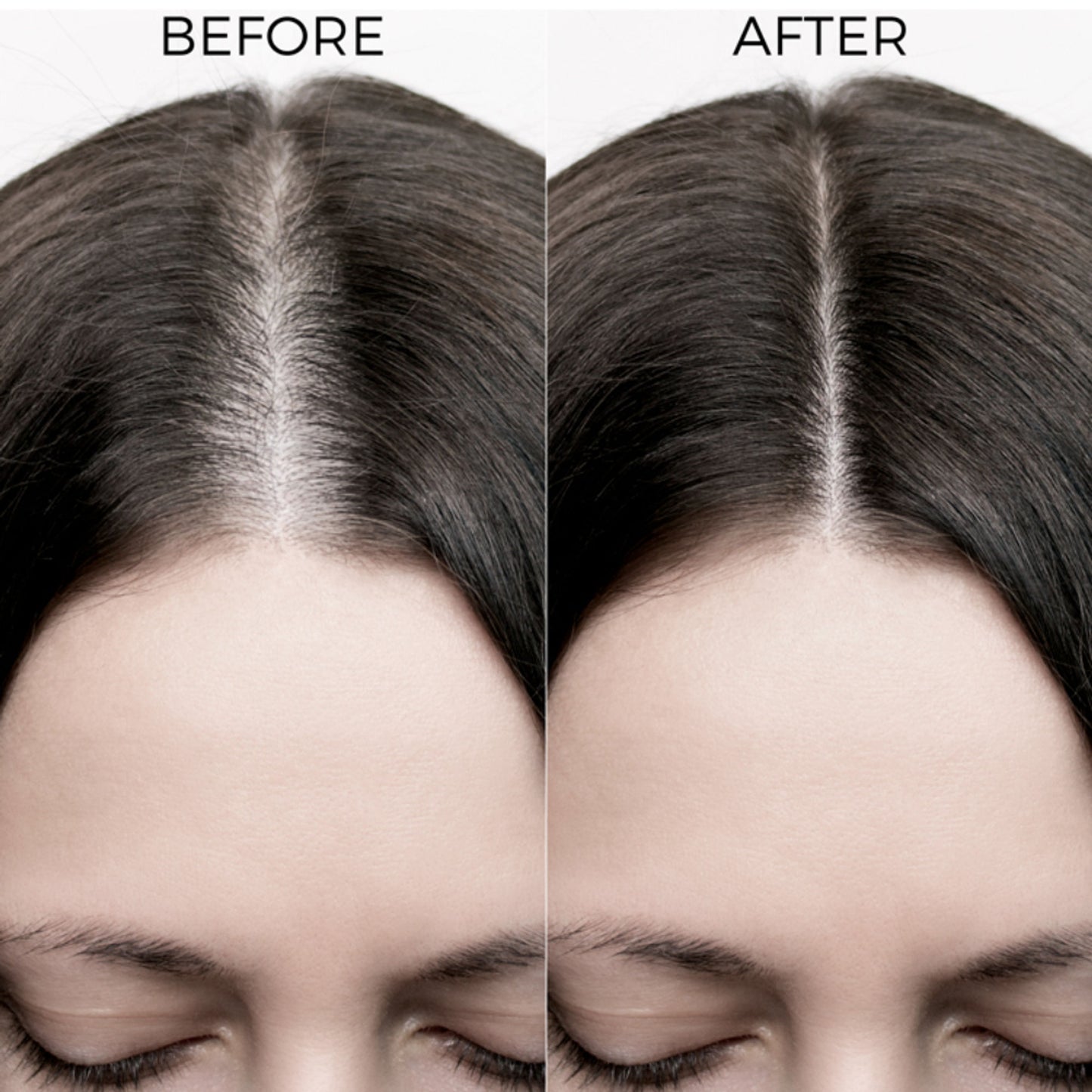 Brillare 2% Caffeine & 3% Redensyl Hair Growth Serum for Scalp | Visible Growth in 4 Weeks