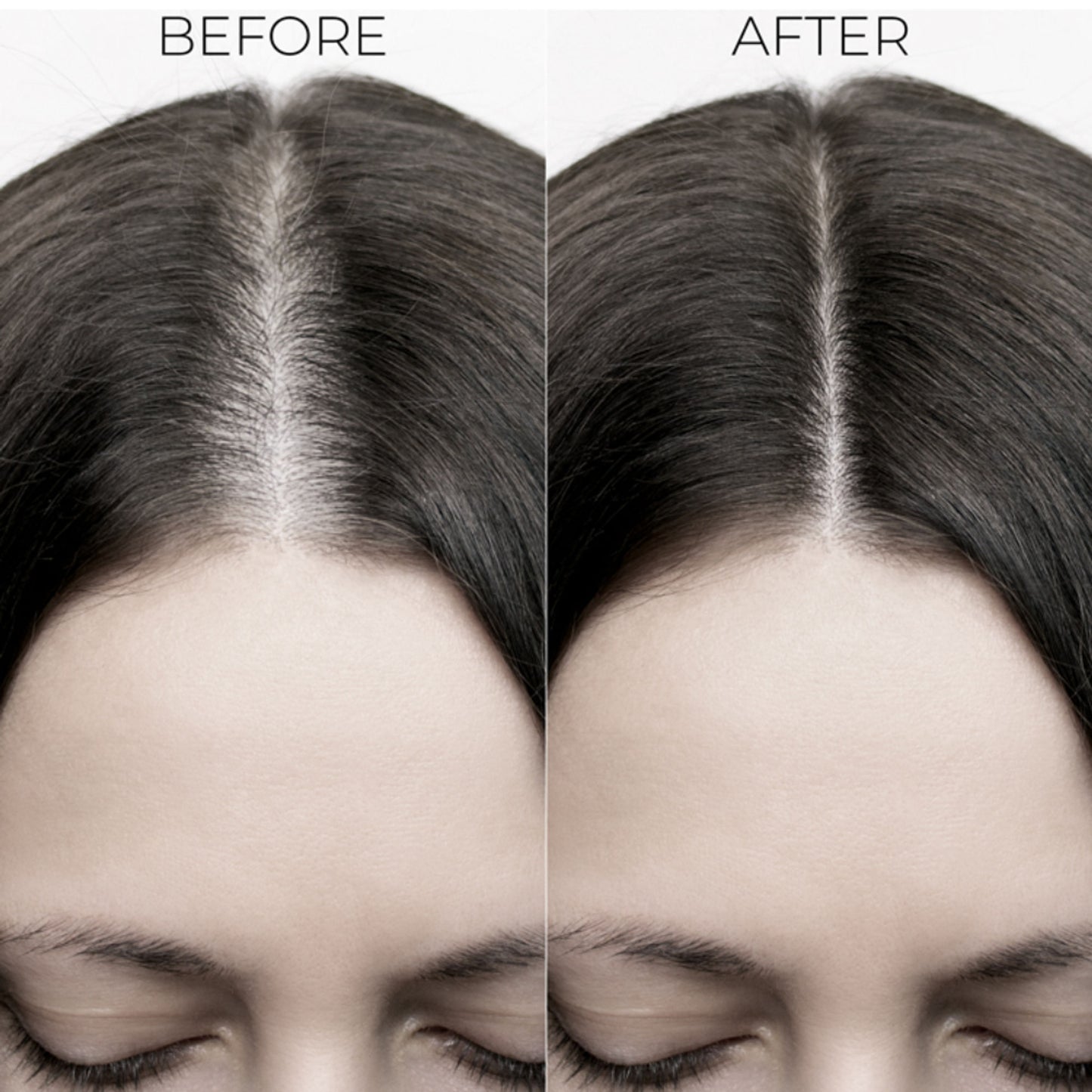 Brillare Professional Hair Fall Control Shampoo Reduces Hair Fall & Prevents Breakage