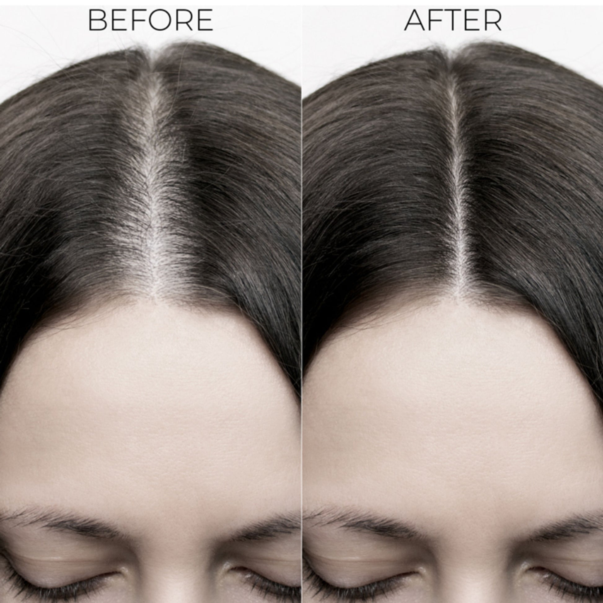 Brillare Professional Hair Fall Control Shampoo Reduces Hair Fall & Prevents Breakage
