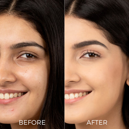Brillare Professional Skin Brightening Face Wash Reduces Pigmentation & Dark Spots