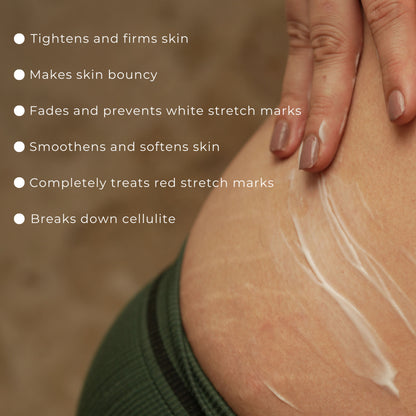Skinvest Bomb bum cream for Stretch Marks + Cellulite