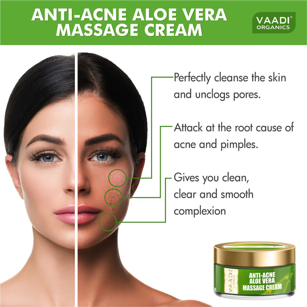 Vaadi Herbals Anti Acne Aloe Vera Massage Cream