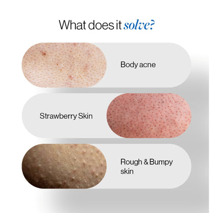 Be Bodywise 1% Salicylic Acid Body Wash, Treats Body Acne & Strawberry Skin - Exfoliating Shower Gel