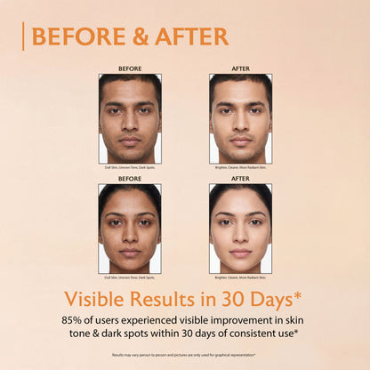 Proskire Advance Vitamin C Face Serum