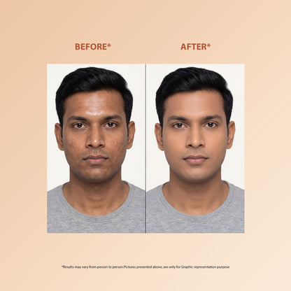 Proskire Skin Perfecting Niacinamide Serum