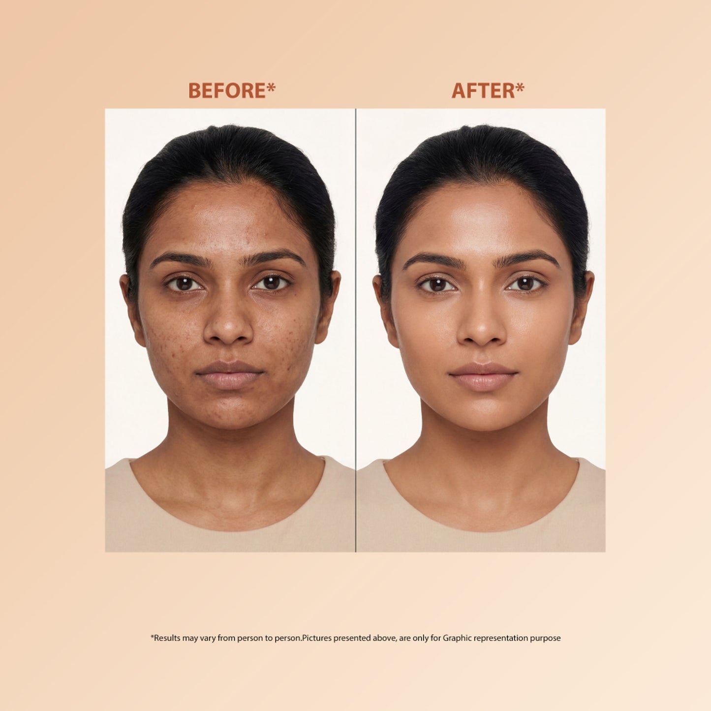 Proskire Skin Perfecting Niacinamide Serum