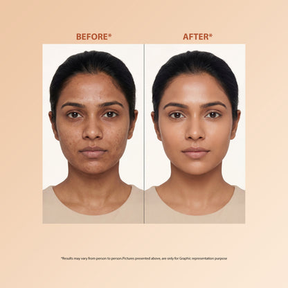 Proskire Skin Perfecting Niacinamide Serum