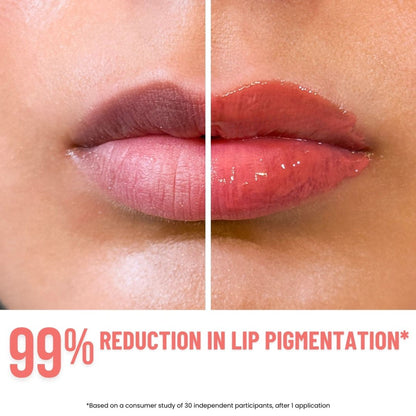 The Skin Diet Company Lip Barrier Butter Balm For Long-Lasting Hydration - Betty's Bliss