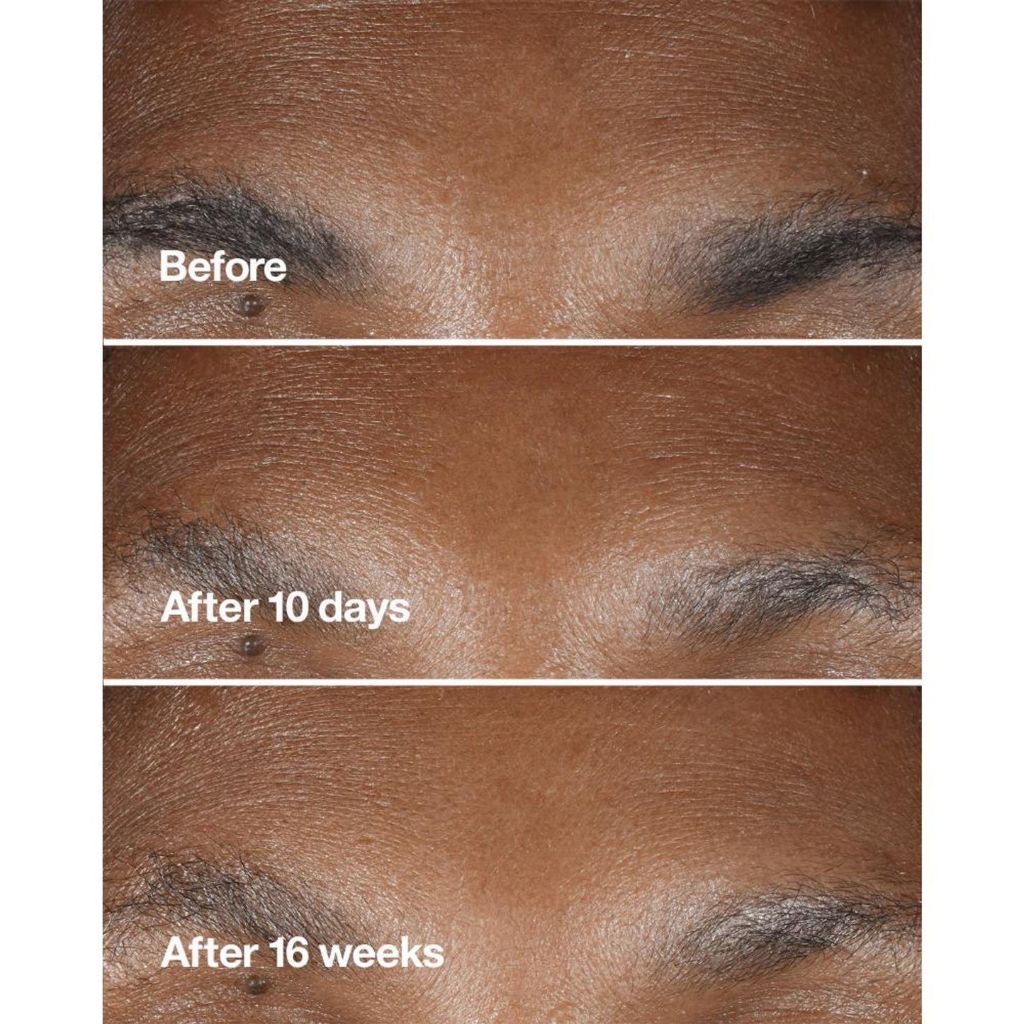 Clinique Smart Clinical Repair Wrinkle Correcting Serum