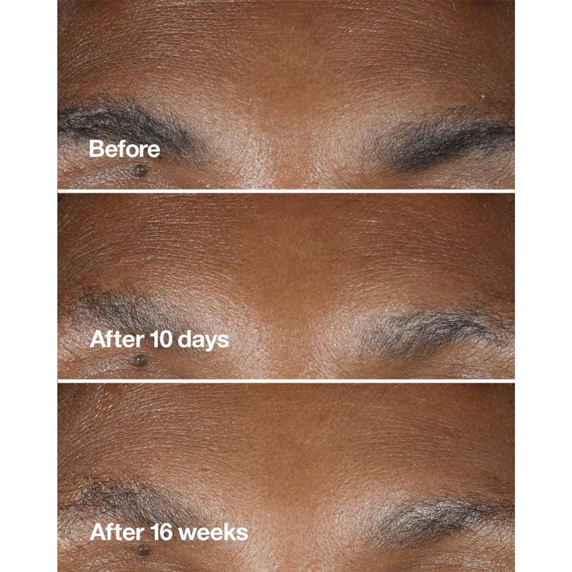 Clinique Smart Clinical Repair Wrinkle Correcting Serum
