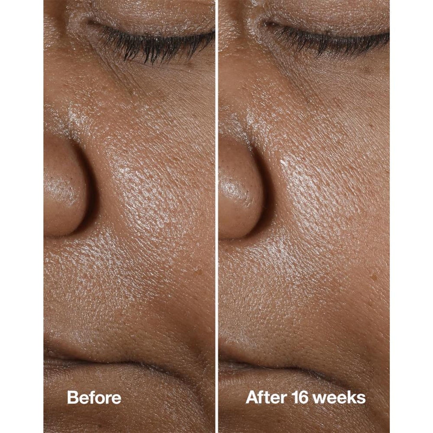 Clinique Smart Clinical Repair Wrinkle Correcting Serum