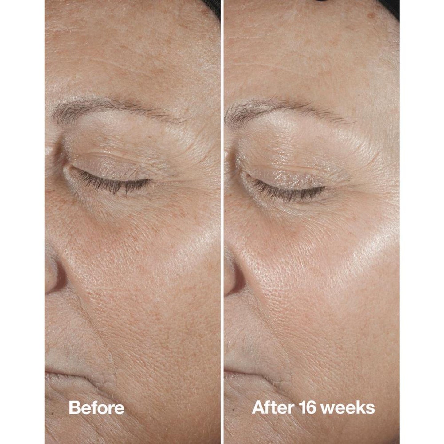 Clinique Smart Clinical Repair Wrinkle Correcting Serum