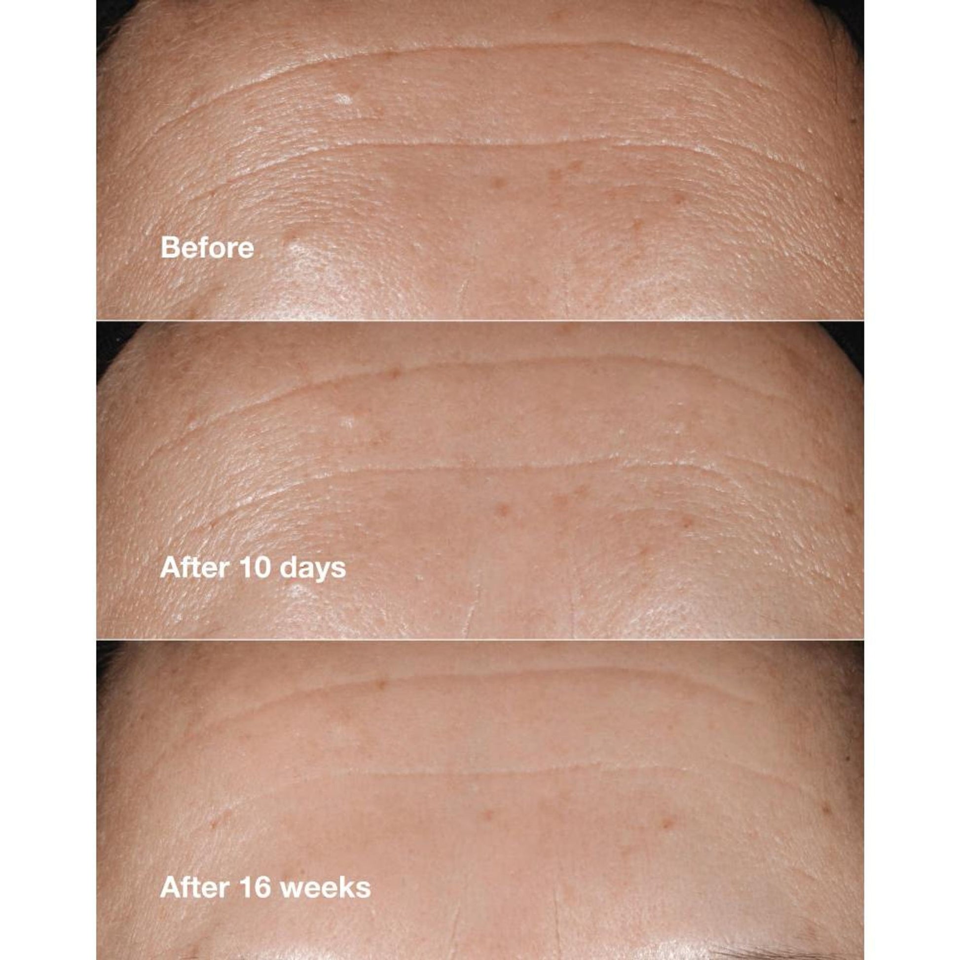 Clinique Smart Clinical Repair Wrinkle Correcting Serum