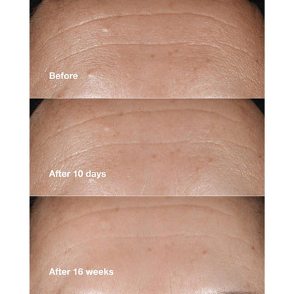 Clinique Smart Clinical Repair Wrinkle Correcting Serum