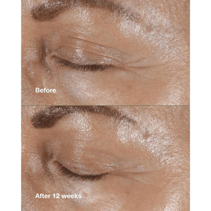 Clinique Smart Clinical Repair Wrinkle Correcting Eye Cream With Peptides