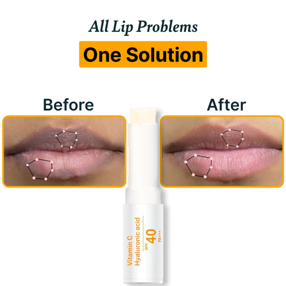 ALANNA Brightening Lip Balm SPF 40 with vanilla flavor, suitable for dark and pigmented lips for men and women.