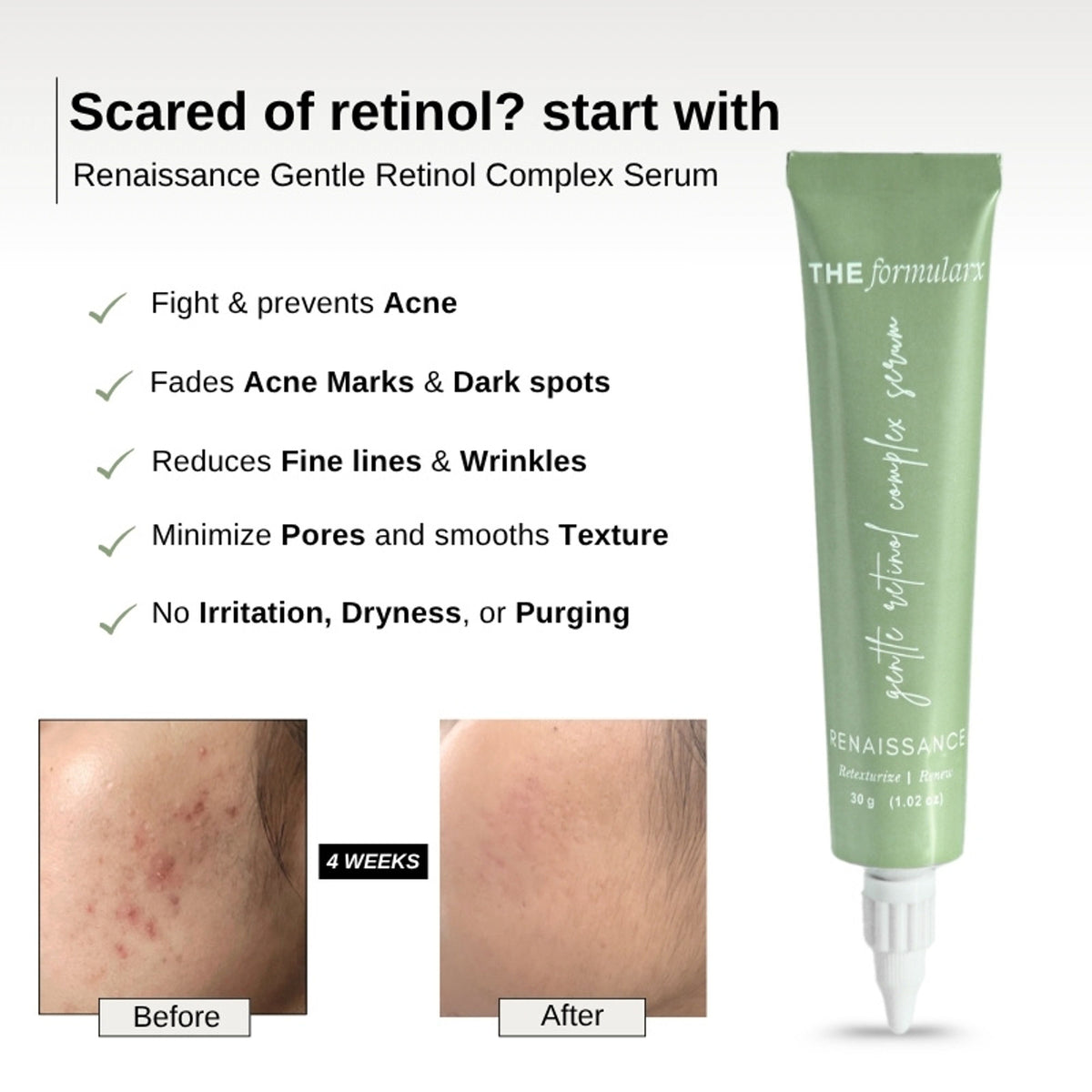 The Formularx Gentle Retinol Night Serum For Acne, Dark Spots, Enlarged Pores & Anti-Aging Care