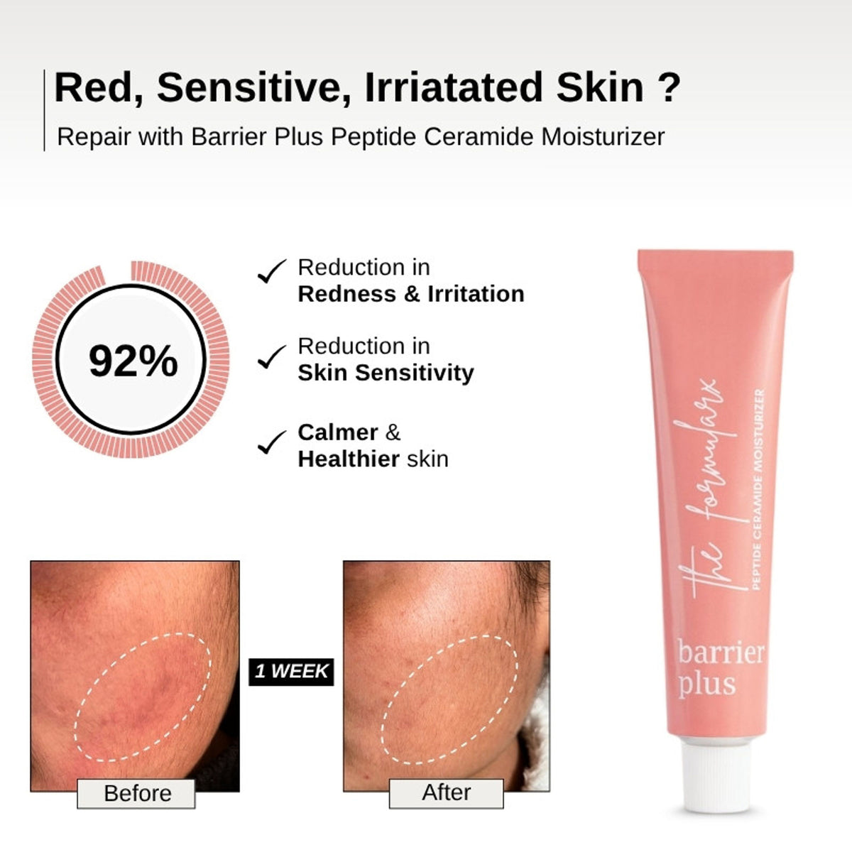 The Formularx Barrier Plus Peptide Ceramide Moisturizer For Dry, Normal, & Sensitive Skin
