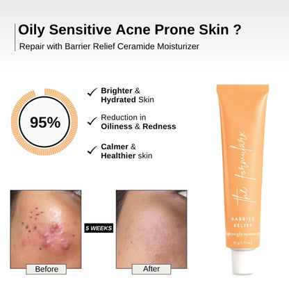 The Formularx Barrier Relief Lightweight Ceramide Moisturizer For Oily, Acne-Prone, Sensitive Skin