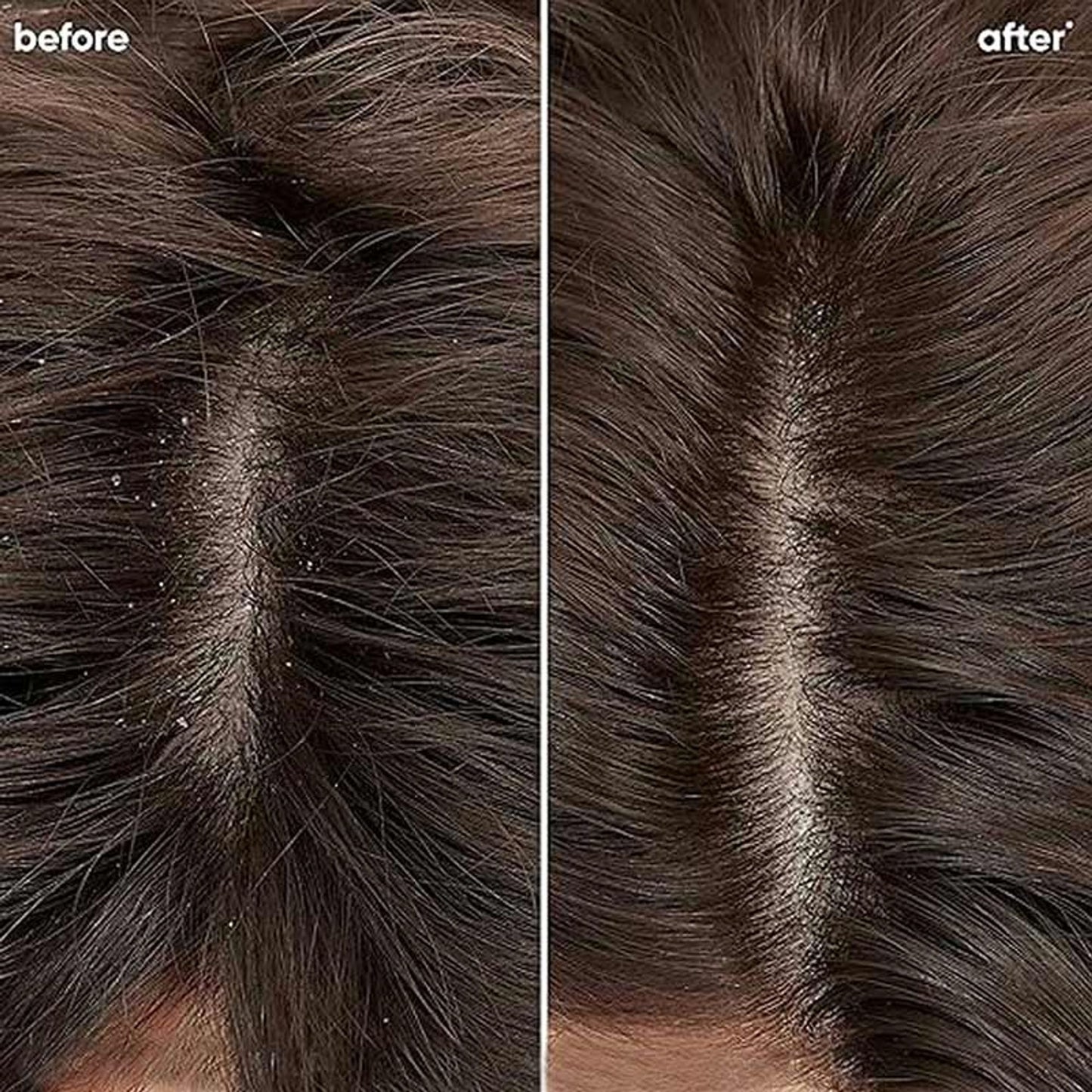 Biolage Scalppure Professional Anti-Dandruff Conditioner, Removes Visible Flakes in 1st WASH