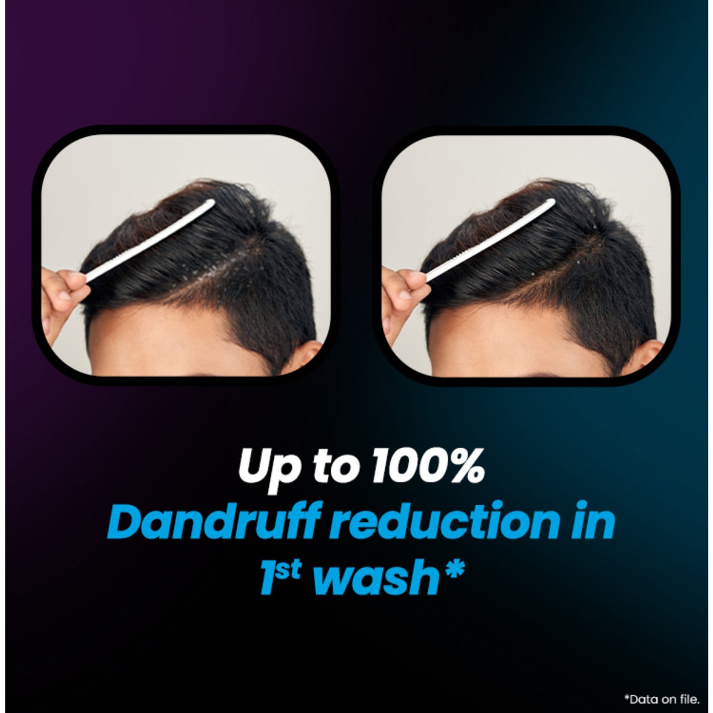 TUGAIN ESSENTIALS Anti Dandruff Shampoo