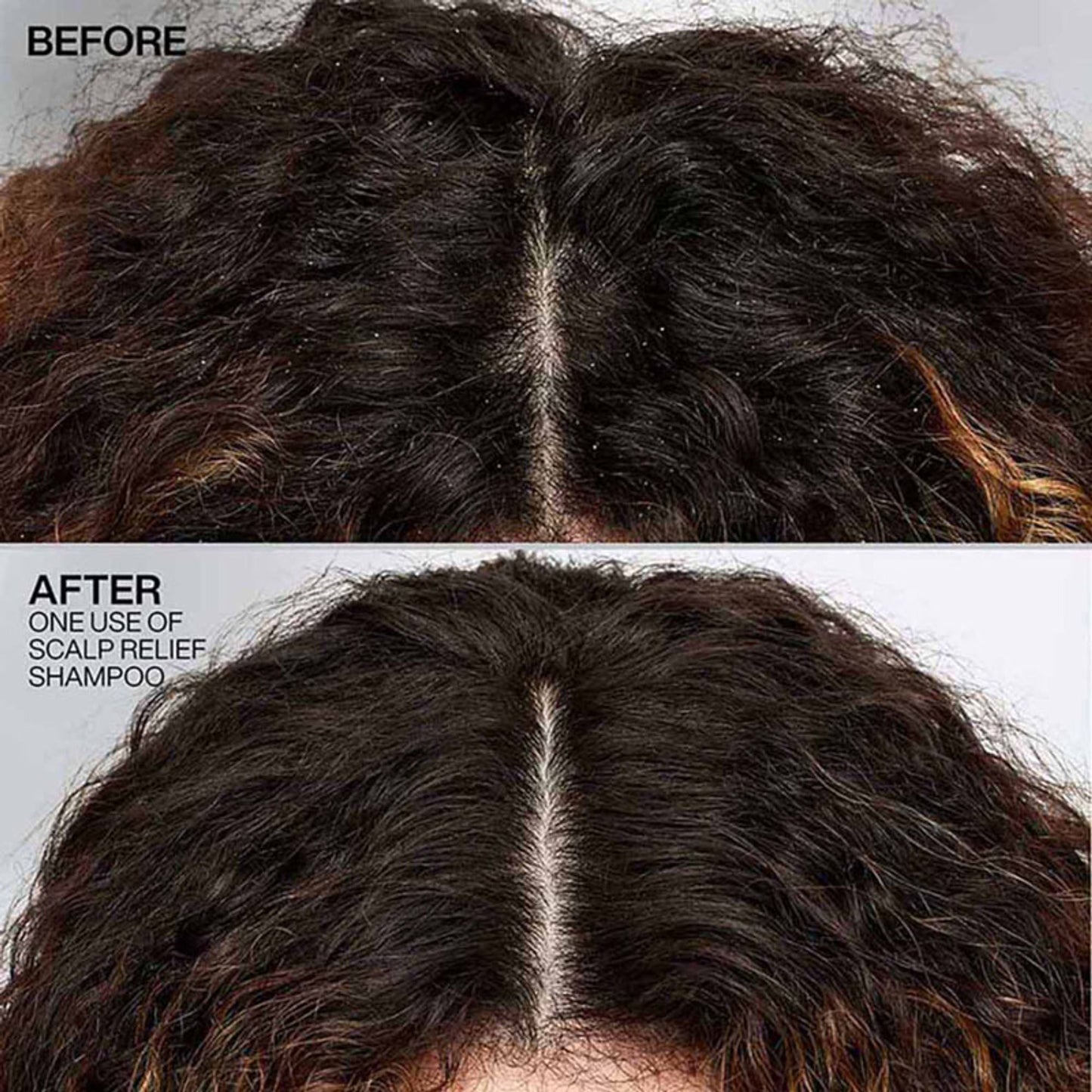 Redken Scalp Relief Anti Dandruff Shampoo For Men & Women
