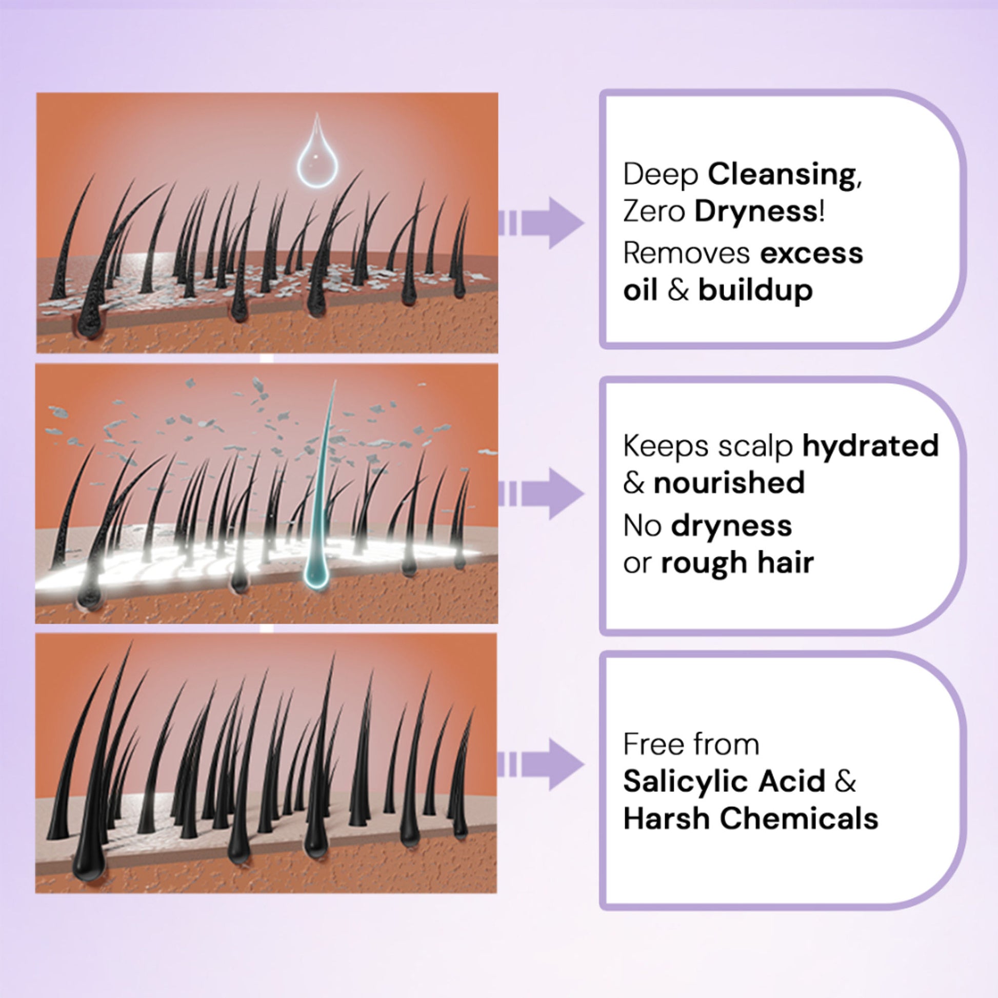 Trigaine Pro Daily Anti Dandruff Shampoo with Climbazole, Prioctone Olamine, ZPTO & Conditioner